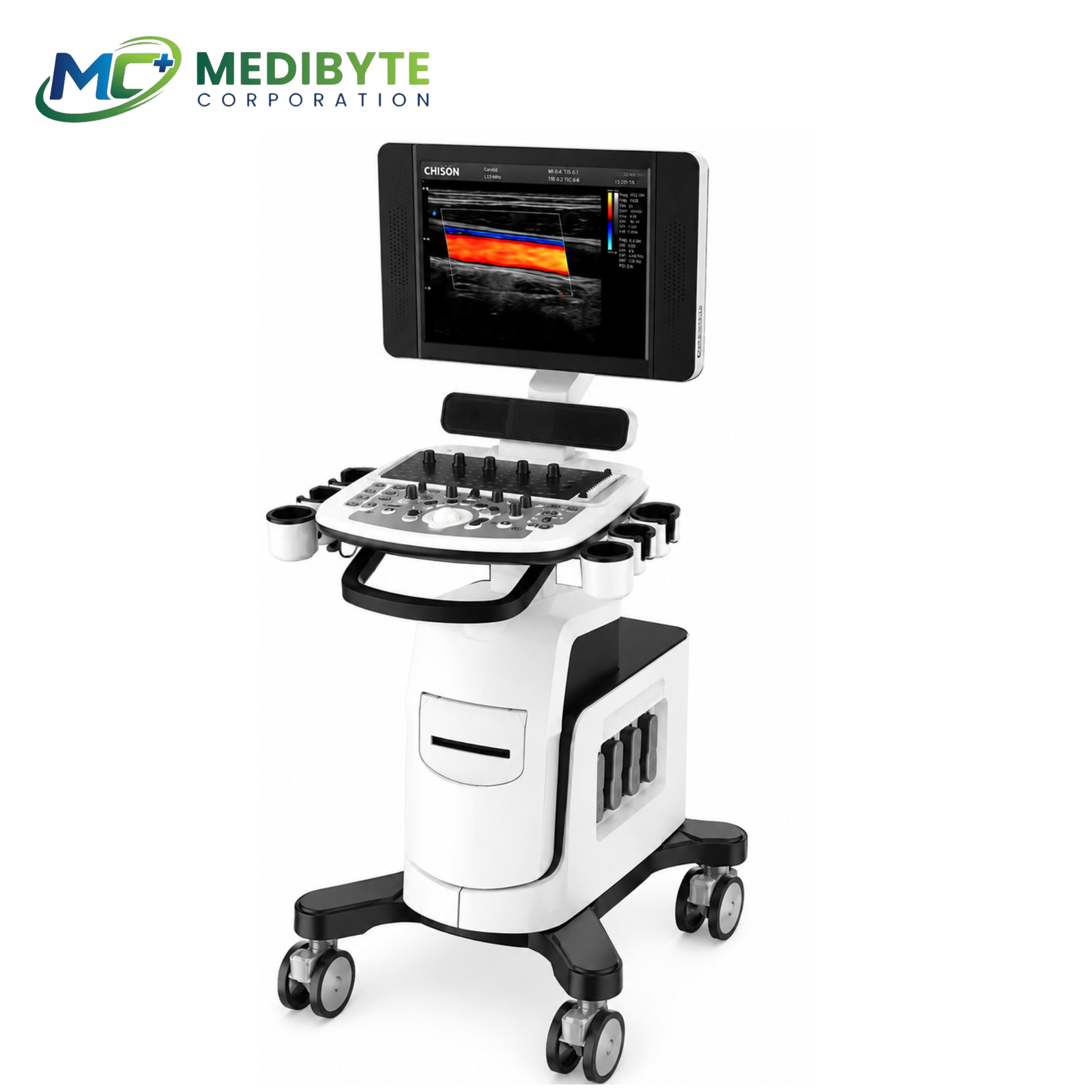 CHISON QBit 5 Color Doppler Ultrasound System